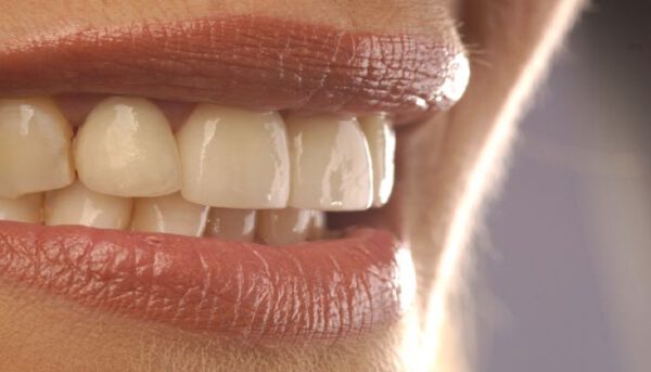 Die richtige Therapie bei Parodontose vom Zahnarzt
