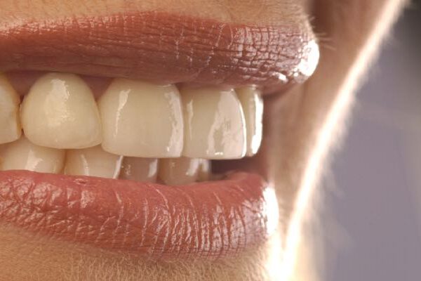 Die richtige Therapie bei Parodontose vom Zahnarzt